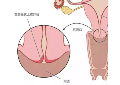 国内代孕哪里好,想要**女孩可以做第三代试管婴儿吗